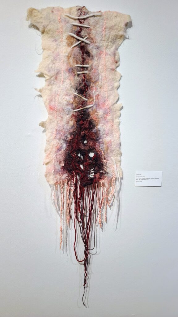 Vertical fiber artwork of felted wool and hanging dark threads, resembling a stitched wound with raw, trailing fibers.