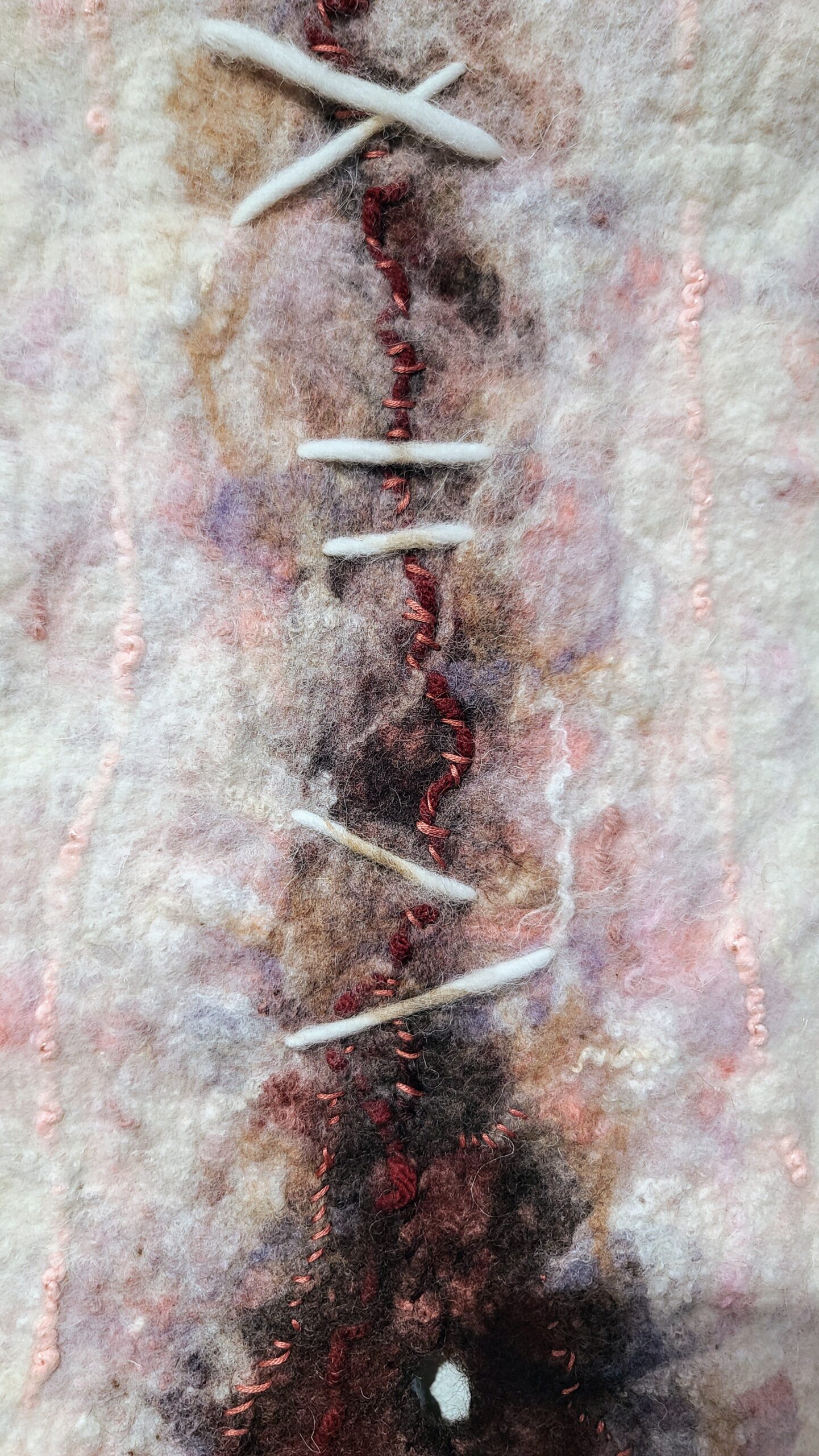 Art as Accessible Therapeutic Modality
